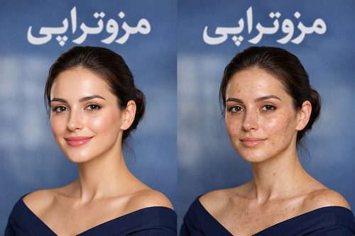 کلینیک مزوتراپی در جهانشهر کرج 